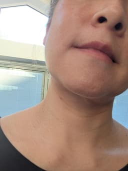 Si SI NEROLISA FACIAL ESSENCE — photo from Noodles88's review