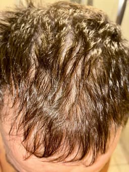 Doctor Aidee Doctor Aidee Vegan LPT Treatment — photo from Paul's review