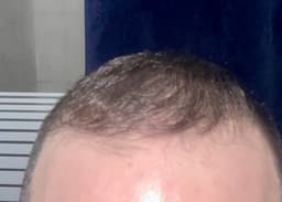 Doctor Aidee Doctor Aidee Vegan Mineral Shampoo — photo from Paul's review