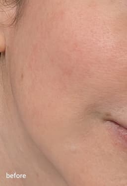 N2U N2U Barrier Glow Mist — photo from Adele's review