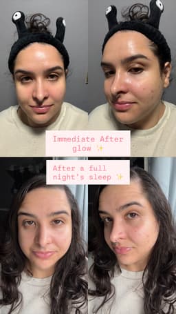 KIERA Vitalizing Hydrogel Collagen Mask — photo from Viviani's review