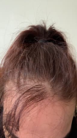 MOGAM Changpo Root Ritual Scalp Serum — Korean Scalp Serum for Itchy, Dry Scalp — photo from zohra's review