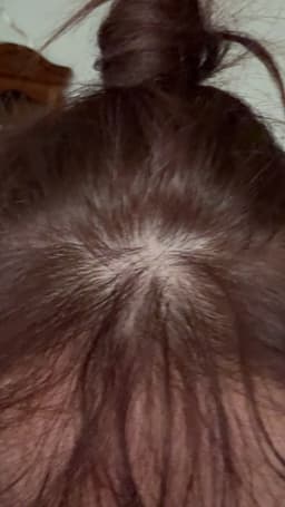 MOGAM Changpo Root Ritual Scalp Serum — Korean Scalp Serum for Itchy, Dry Scalp — photo from zohra's review