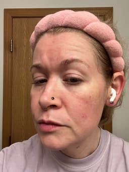 WOLLYO Azulene Blue Cleansing Balm 100ml — photo from hazelmoss's review