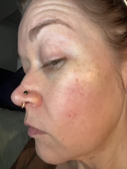 WOLLYO Azulene Cica Repair Cream 55g — photo from hazelmoss's review