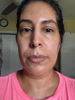 Si SI NEROLISA FACIAL ESSENCE — photo from Dee's review